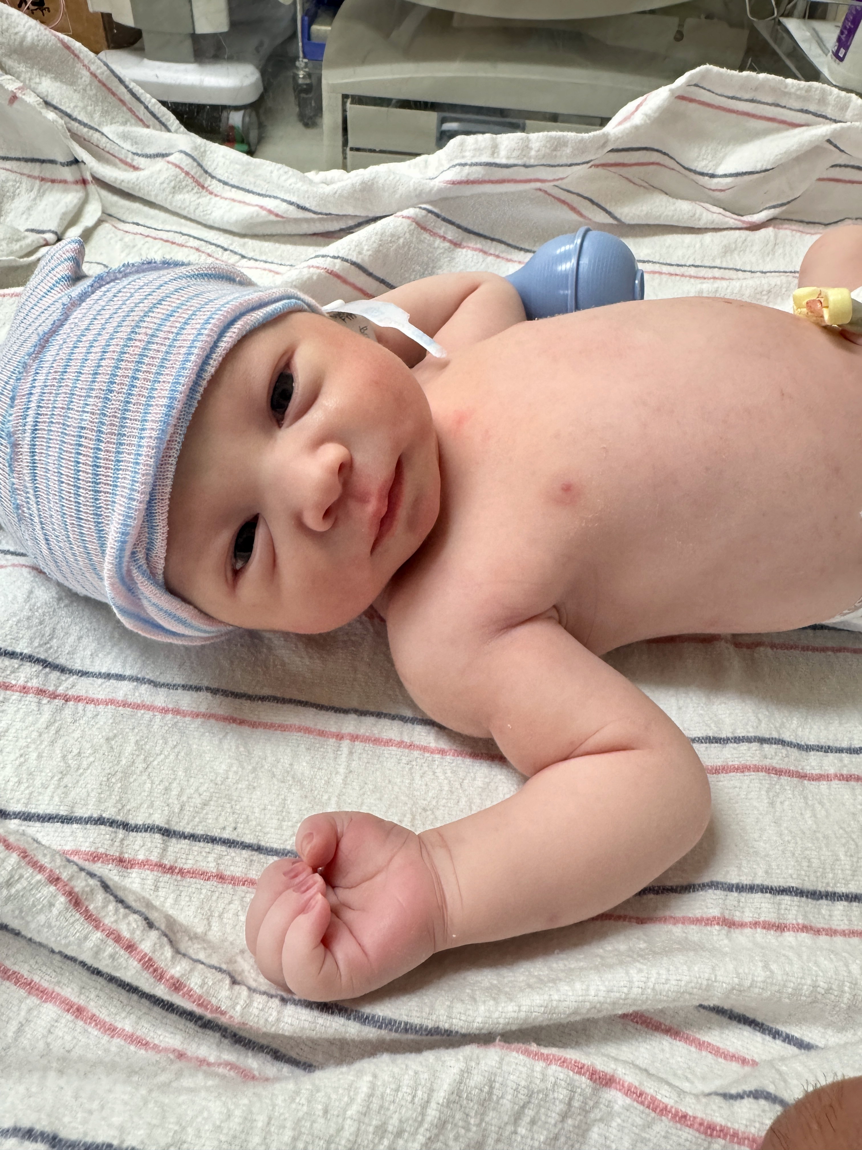 Nate resting on a striped hospital blanket
